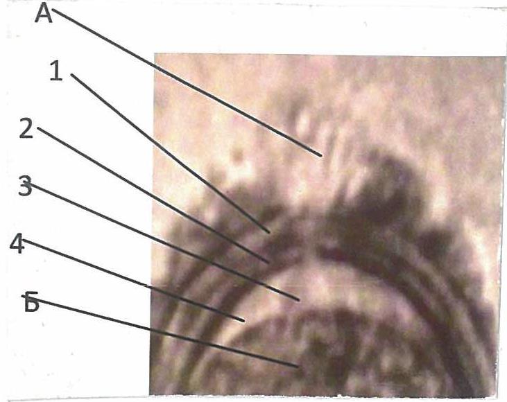 Крышечка имеет вид кисточки (рис., А), соединённой тонкой ножкой (3) с зародышем 